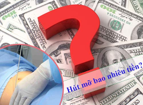 Hút mỡ không phẫu thuật giá bao nhiêu? – Chi phí trọn gói và từng vùng