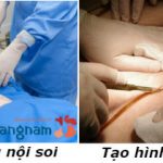 Phẫu thuật tạo hình thành bụng là gì? Giá bao nhiêu và các lưu ý sau khi phẫu thuật