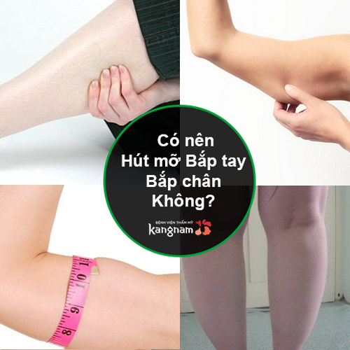 Có nên hút mỡ bắp chân, bắp tay? – {Review chuyên gia + khách hàng}