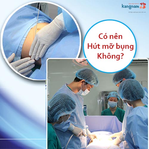 Có nên đi hút mỡ bụng không? Hút mỡ bụng như thế nào???