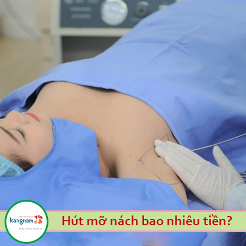 Hút mỡ nách bao nhiêu tiền? Cập nhật bảng giá mới nhất