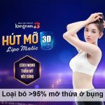 Thẩm mỹ nội soi hút mỡ bụng không phẫu thuật 1 lần duy nhất giữ eo 56 trọn đời