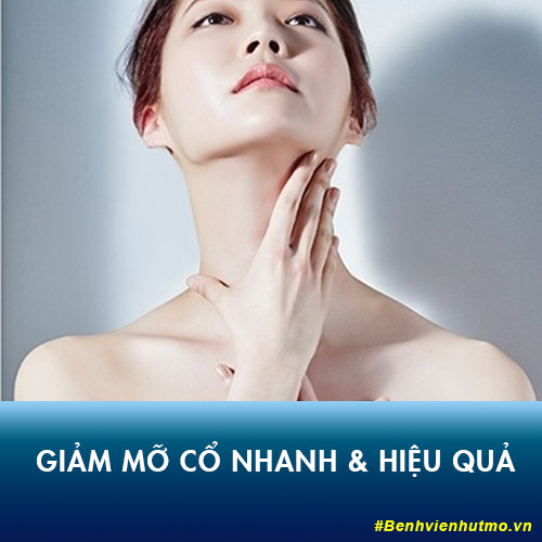 10 cách giảm mỡ cổ tự nhiên tại nhà hiệu quả cấp tốc sau 1 tuần