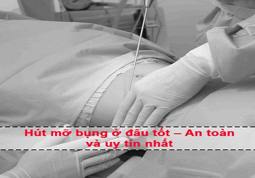 LIST địa chỉ hút mỡ bụng ở đâu an toàn, uy tín và tốt nhất Hà Nội, TPHCM?