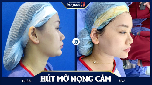 tóc hợp với mặt tròn