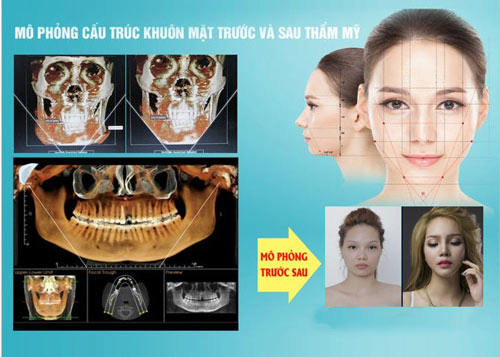 thẩm mỹ kangnam 