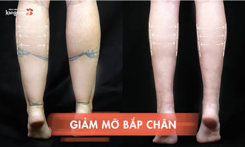 ăn khoai môn buổi tối có mập không