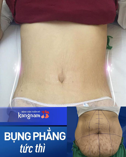 ăn nhiều bánh gạo có béo không