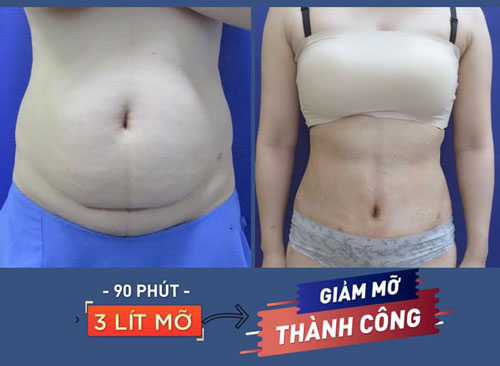 ăn ốc giảm cân