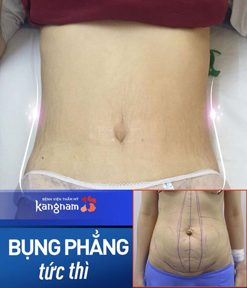 ăn trứng gà có tốt không