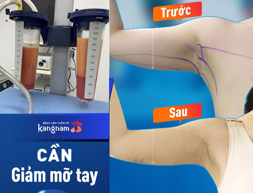 củ đậu có tốt không