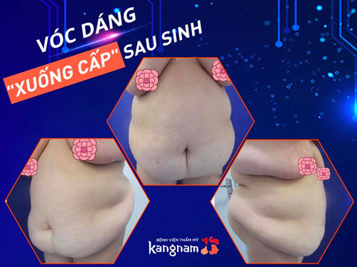 giảm cân bằng uống rau diếp cá