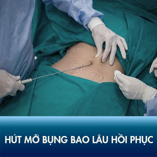 Hút mỡ bụng bao lâu hồi phục? Bác sĩ hướng dẫn chăm sóc sau hút mỡ bình phục nhanh chóng!