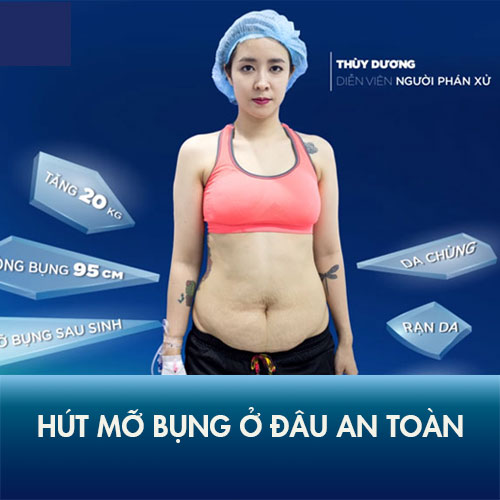 Hút mỡ bụng ở đâu an toàn? Review địa chỉ hút mỡ an toàn tại Hà Nội và TP.HCM!