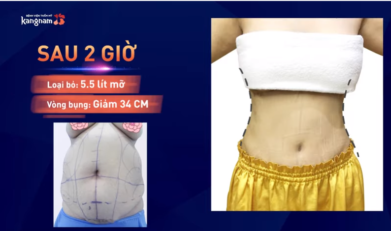 phương pháp giảm cân bằng mật ong