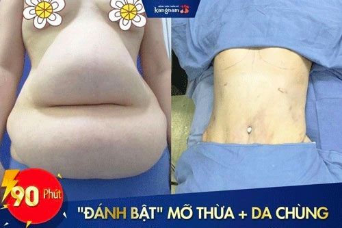 ăn nhiều hướng dương có béo không 