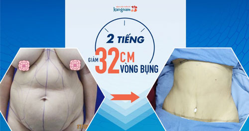 mẹ bầu ăn mãng cầu có tốt không