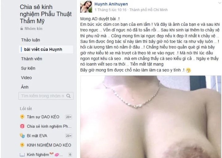 Khách hàng bức xúc cho rằng “Bệnh viện thẩm mỹ kangnam lừa đảo” được chia sẻ trên nhóm Chia sẻ kinh nghiệm phẫu thuật